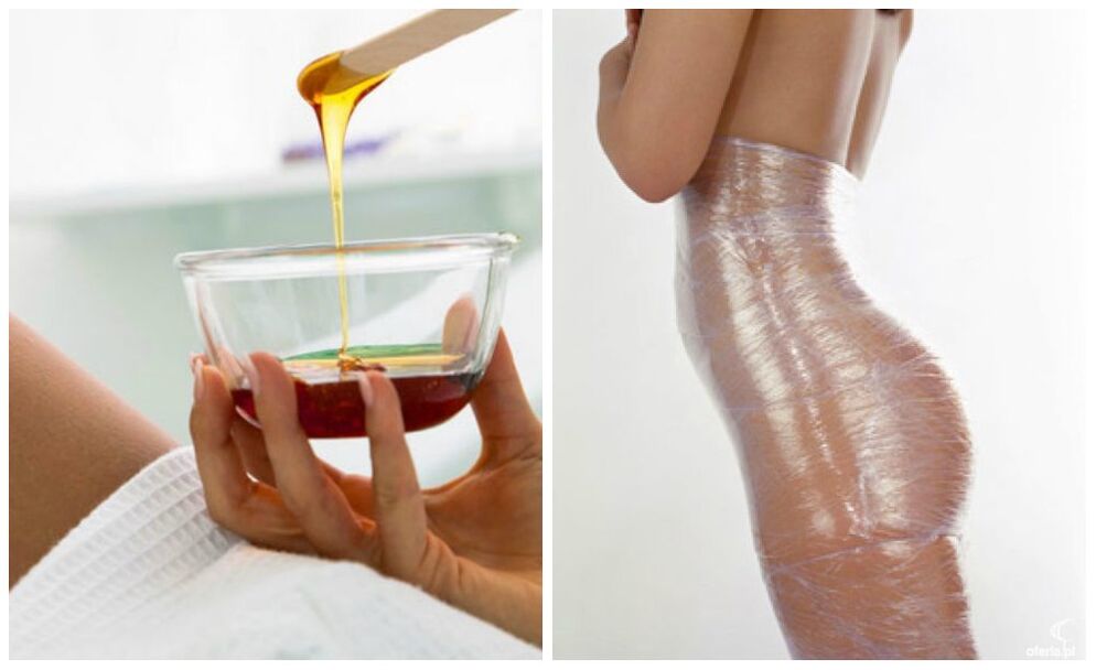 ihe mkpuchi ahụ maka ịbelata ibu